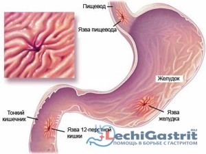 Шлунок: хвороби, симптоми і лікування патологій