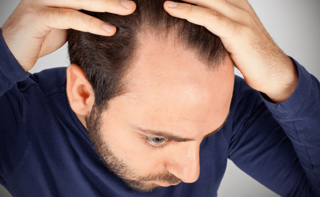 Чоловічі зачіски з залисинами на лобі – фото та рекомендації