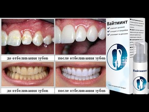 Огляд пінки для відбілювання зубів «WhiteMint»: відгуки, склад, інструкція по застосуванню і вартість