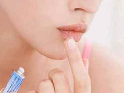 Чому тріскаються куточки губ і як лікувати: найбільш ефективні способи