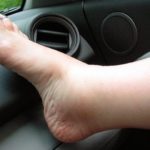 Набряки при гіпертонії: лікування отекающих ніг та обличчя