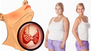 Гіпотиреоз під час вагітності або інші захворювання щитовидної залози: як вони впливають на плід, може на тлі гіпотиреозу бути порушення в роботі органів плоду, і що робити