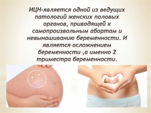 ИЦН при вагітності: як проходить лікування, якщо відкритий внутрішній зів, причини розкриття і методи діагностики, профілактика, група ризику серед вагітних і небезпечні моменти