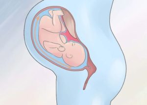 Маловоддя при вагітності: як самостійно визначити виражене, наслідки для дитини, що робити, якщо відносне маловоддя перед пологами