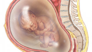 Багатоводдя при вагітності: причини і наслідки вираженою або відносної форми захворювання в третьому триместрі, як позбутися медикаментами або народними засобами