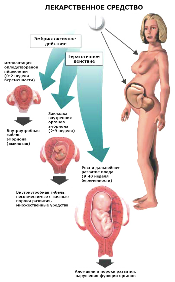 Застуда при вагітності: чим небезпечна на ранніх термінах, як лікувати перед пологами і які засоби протипоказані для лікування ГРВІ під час вагітності